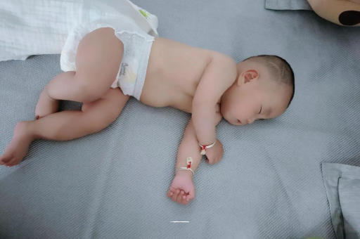 昌都六个月宝宝眼睛散光